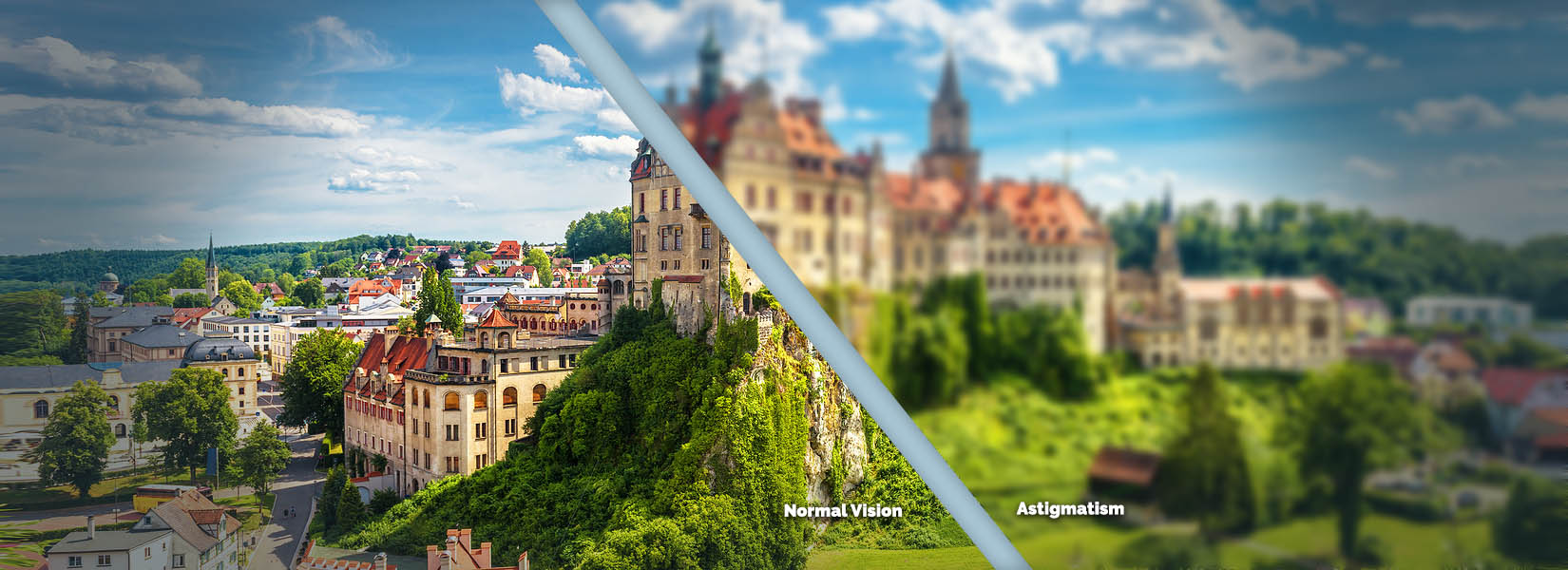 Astigmatism Treatment in Sidney