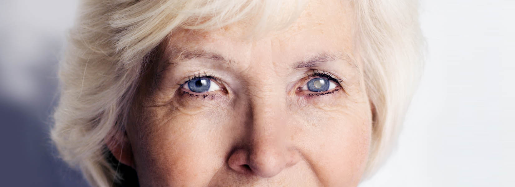 Cataract Surgery in Sidney